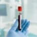 Person with a medical glove holding up a vial containing a blood sample
