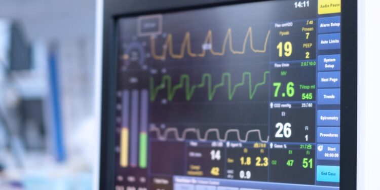 Ventilator machine close-up