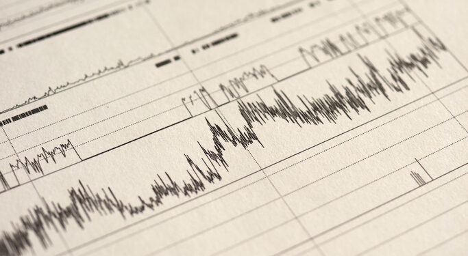 Whistleblower Receives $300,000 for Qui Tam Suit Against Florida Sleep Center