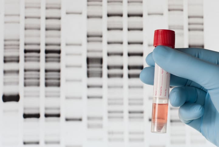 Genomic Testing