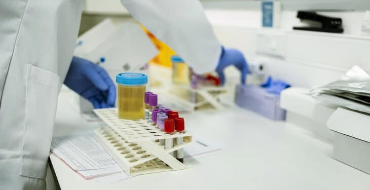 Lab Tests