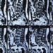Spinal Surgery Whistleblower